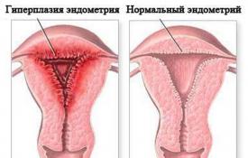 Normal endometrial thickness in menopause and features of the development of endometrial hyperplasia