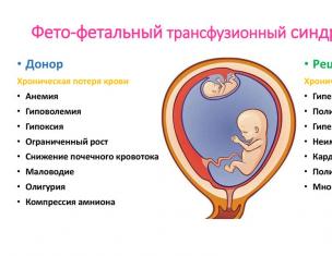 Feto-fetalni transfuzijski sindrom kod blizanaca: klasifikacija i mogućnosti liječenja