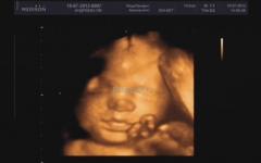 Foto på fostret, foto på buken, ultraljud och video om barnets utveckling Graviditet 30 31 veckor allt