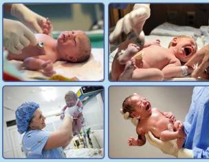 Procjena novorođenčadi pomoću Apgarove skale: dekodiranje