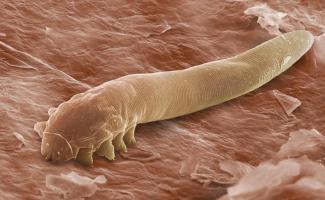 Demodex mite on the face: causes, symptoms and treatment features